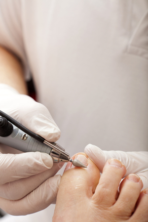 Simply Foot Care, Chiropody and Podiatry in Dursley Gloucestershire