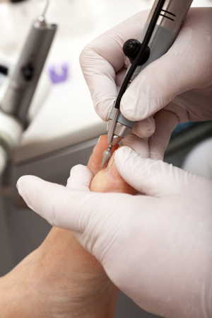 Simply Foot Care, Chiropody and Podiatry in Dursley Gloucestershire