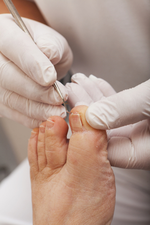 Simply Foot Care, Chiropody and Podiatry in Dursley Gloucestershire
