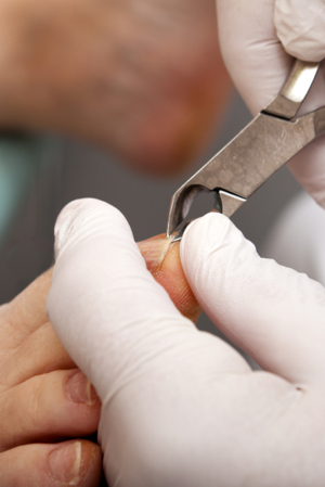 Simply Foot Care, Chiropody and Podiatry in Dursley Gloucestershire