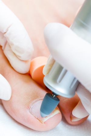 Simply Foot Care, Chiropody and Podiatry in Dursley Gloucestershire